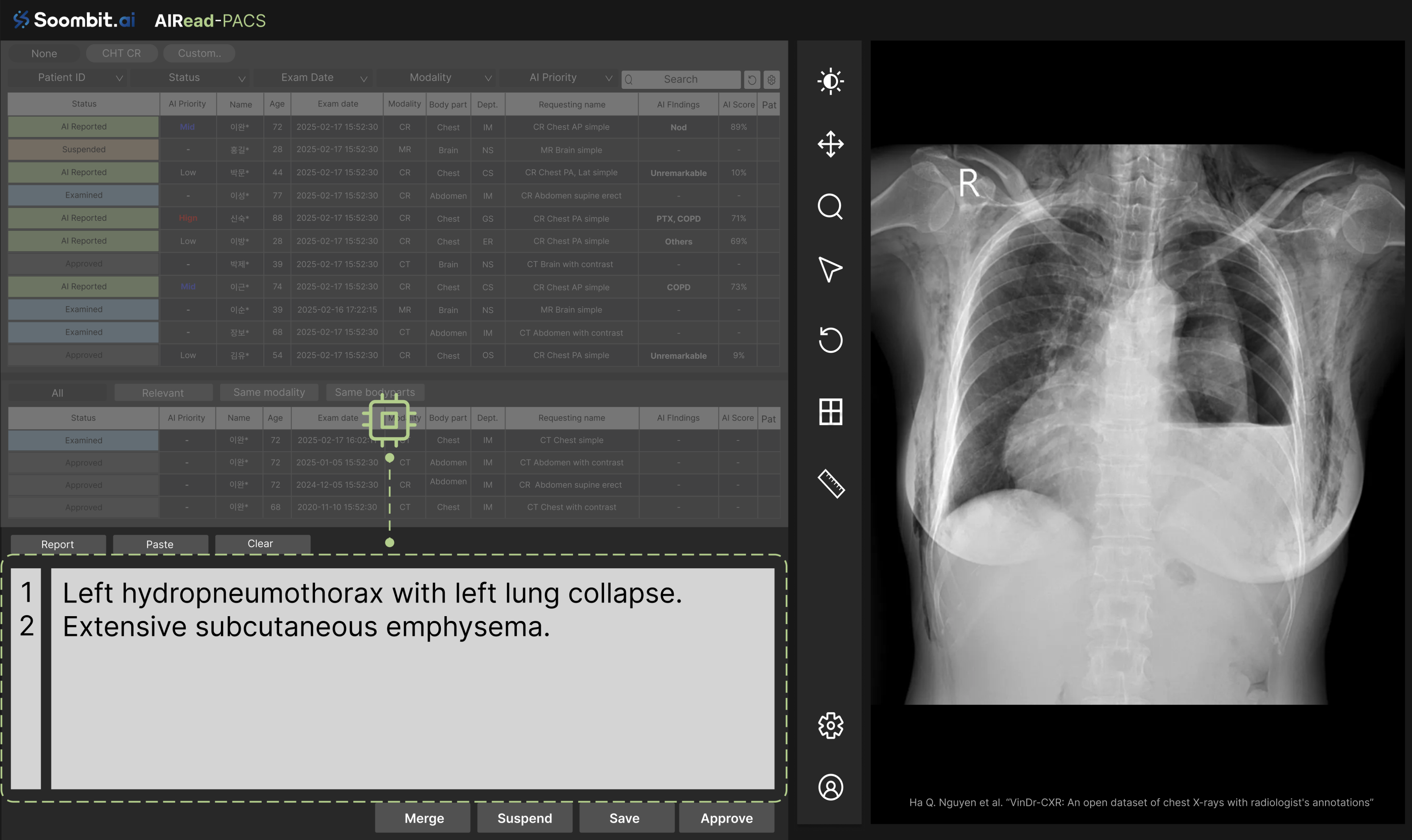 AIRead-PACS Interface